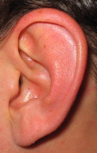 Ear-1